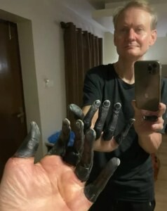 Ruski alpinist po izgubi šestih prstov toži vodnika zaradi poskusa umora